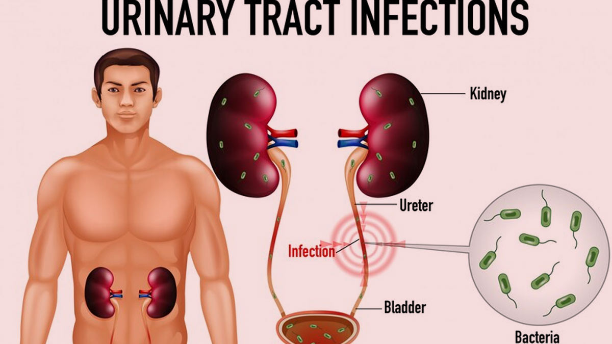 blood-in-urine-to-frequent-urination-how-does-uti-affect-men